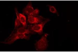 ABIN6278417 staining NIH-3T3 by IF/ICC. (TACR2 抗体  (C-Term))