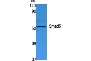 Western Blotting (WB) image for anti-SMAD, Mothers Against DPP Homolog 5 (SMAD5) (Internal Region) antibody (ABIN3187646) (SMAD5 抗体  (Internal Region))