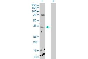 Western Blot analysis of CHP expression in transfected 293T cell line by CHP MaxPab polyclonal antibody. (CHP 抗体  (AA 1-195))
