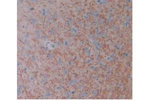 Detection of FGF1 in Rat Brain Tissue using Monoclonal Antibody to Fibroblast Growth Factor 1, Acidic (FGF1) (FGF1 抗体  (AA 16-155))