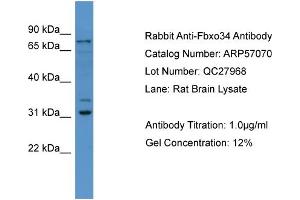 WB Suggested Anti-Fbxo34  Antibody Titration: 0.