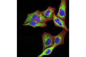 Immunocytochemistry (ICC) image for anti-Proteasome (Prosome, Macropain) 26S Subunit, ATPase, 3 (PSMC3) (AA 53-152) antibody (ABIN5542634)