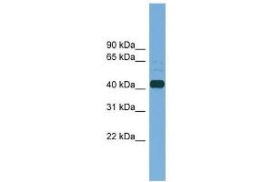 PLAT antibody used at 1 ug/ml to detect target protein. (PLAT 抗体  (Middle Region))