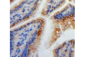 IHC-P analysis of Stomach tissue, with DAB staining. (FABP2 抗体  (AA 2-132))