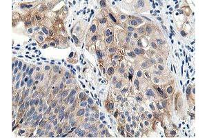 Image no. 5 for anti-Leucine Carboxyl Methyltransferase 1 (LCMT1) antibody (ABIN1499107) (LCMT1 抗体)