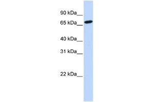 WB Suggested Anti-HAL Antibody Titration:  1 ug/ml  Positive Control:  721_B cell lysate (HAL 抗体  (N-Term))