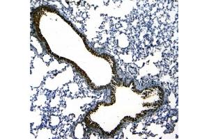 IHC testing of FFPE rat lung tissue with Scgb1a1 antibody at 1ug/ml.