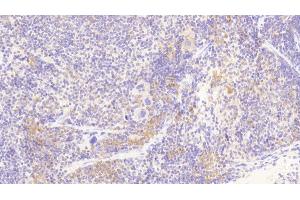Immunohistochemistry (IHC) image for anti-Mast/stem Cell Growth Factor Receptor (KIT) (AA 343-527) antibody (ABIN7431110)