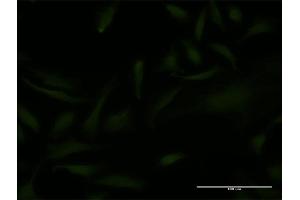 Immunofluorescence of monoclonal antibody to EMX2 on HeLa cell.