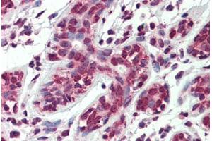 Human Breast: Formalin-Fixed, Paraffin-Embedded (FFPE) (ARL2 抗体  (AA 123-184))