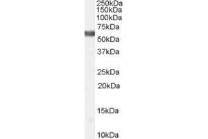 ABIN334451 (2µg/ml) staining of Human Thyroid lysate (35µg protein in RIPA buffer).
