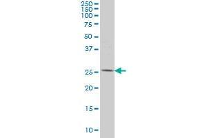PYCRL monoclonal antibody (M01), clone 4F11 Western Blot analysis of PYCRL expression in HeLa . (PYCRL 抗体  (AA 32-131))