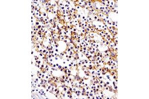 Antibody staining D11b in human tonsil tissue sections by Immunohistochemistry (IHC-P - paraformaldehyde-fixed, paraffin-embedded sections). (CD11b 抗体  (N-Term))