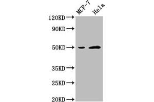 Western Blot Positive WB detected in: MCF-7 whole cell lysate, Hela whole cell lysate All lanes: SLC16A3 antibody at 1:2500 Secondary Goat polyclonal to rabbit IgG at 1/50000 dilution Predicted band size: 50 kDa Observed band size: 50 kDa (SLC16A3 抗体  (AA 406-465))