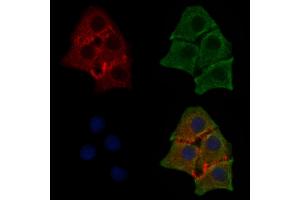 ABIN6255818 and ABIN6267580 staining HepG2 cells(30 min of 4uM Forskolin treatment) by IF/ICC. (CDK5 抗体  (pTyr15))