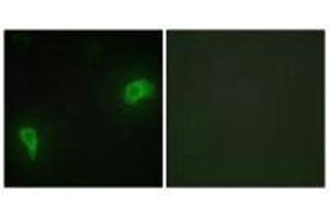 Immunofluorescence analysis of HepG2 cells, using DOK7 antibody. (DOK7 抗体  (N-Term))