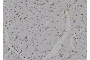 ABIN6277154 at 1/100 staining Human gastric tissue by IHC-P. (IRF3 抗体  (C-Term))