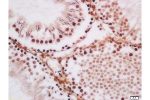 Paraformaldehyde-fixed, paraffin embedded rat testis Antigen retrieval by boiling in sodium citrate buffer (pH6. (TLK1 抗体  (AA 458-560))