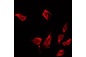 ABIN6272326 staining LOVO by IF/ICC. (IFIT1 抗体  (Internal Region))