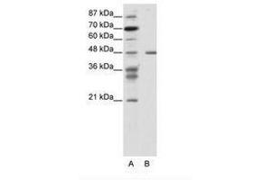 Image no. 1 for anti-Proteasome (Prosome, Macropain) 26S Subunit, ATPase, 2 (PSMC2) (N-Term) antibody (ABIN343937) (PSMC2 抗体  (N-Term))