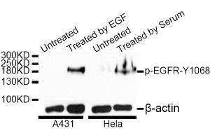 Western blot analysis of extracts of A-431 and HeLa cells, using Phospho-EGFR-Y1068 antibody. (EGFR 抗体  (pTyr1068))