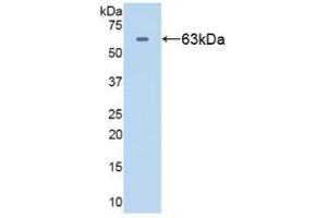 Western blot analysis of recombinant Human HSPD1. (HSPD1 抗体  (AA 1-573))
