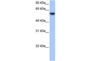 Western Blotting (WB) image for anti-Inositol-3-Phosphate Synthase 1 (ISYNA1) antibody (ABIN2463597) (ISYNA1 抗体)