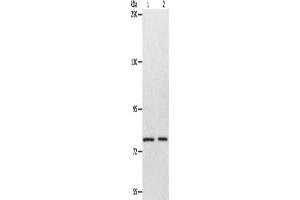 Gel: 8 % SDS-PAGE, Lysate: 40 μg, Lane 1-2: Mouse liver tissue, SP20 cells, Primary antibody: ABIN7128119(ABCB6 Antibody) at dilution 1/320, Secondary antibody: Goat anti rabbit IgG at 1/8000 dilution, Exposure time: 1 minute (ABCB6 抗体)