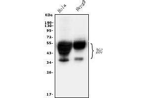 Western blot analysis of CD147/Emmprin using anti-CD147/Emmprin antibody (ABIN5518743). (CD147 抗体  (AA 138-323))