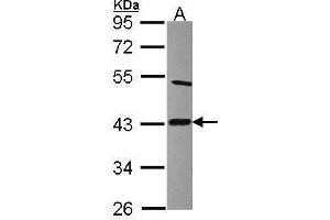 WB Image Sample (30 ug of whole cell lysate) A: Raji 10% SDS PAGE antibody diluted at 1:2000 (LIAS 抗体)
