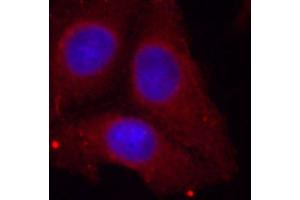 Immunofluorescence staining of methanol-fixed HeLa cells using Phospho-GAP43-S41 antibody (ABIN2988022). (GAP43 抗体  (pSer41))