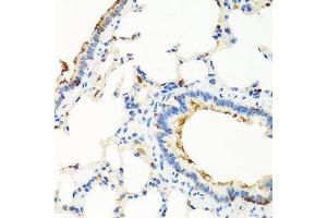 Immunohistochemistry of paraffin-embedded rat lung using RGS5 antibody at dilution of 1:100 (x40 lens). (RGS5 抗体)