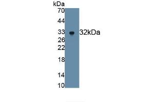 Detection of Recombinant MMP7, Human using Monoclonal Antibody to Matrix Metalloproteinase 7 (MMP7) (MMP7 抗体  (AA 18-267))