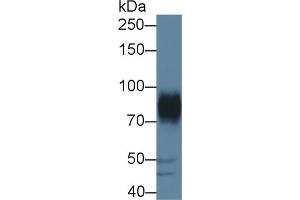 Detection of ADAM22 in Porcine Cerebrum lysate using Polyclonal Antibody to A Disintegrin And Metalloprotease 22 (ADAM22) (ADAM22 抗体  (AA 370-582))