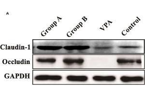 Expression of claudin-1 and occludin in the colonic tissues of different groups. (Occludin 抗体  (AA 350-450))