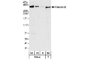 Western Blotting (WB) image for anti-Filamin B, beta (FLNB) (AA 1225-1275) antibody (ABIN7453085)