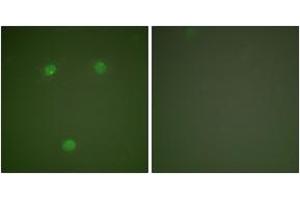 Immunofluorescence (IF) image for anti-DNA-Damage-Inducible Transcript 3 (DDIT3) (AA 91-140) antibody (ABIN2889202) (DDIT3 抗体  (AA 91-140))