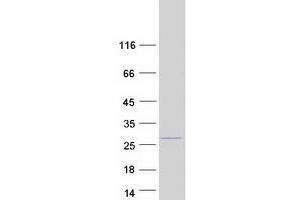 Western Blotting (WB) image for Vacuolar Protein Sorting 29 (VPS29) (Transcript Variant 2) protein (Myc-DYKDDDDK Tag) (ABIN2735422)