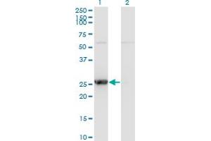 Western Blot analysis of TK1 expression in transfected 293T cell line by TK1 monoclonal antibody (M07), clone 3G10. (TK1 抗体  (AA 1-234))