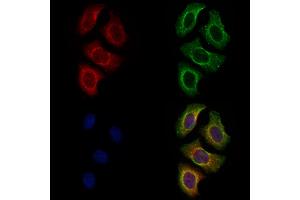 ABIN7094622 and ABIN7098672 staining Hela cells by IF/ICC. (Plexin A4 抗体  (C-Term))