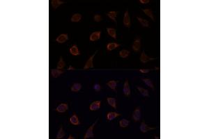 Immunofluorescence analysis of L929 cells using DUSP8 antibody (ABIN7266849) at dilution of 1:100. (DUSP8 抗体)