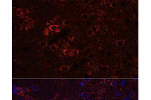Immunofluorescence (IF) image for anti-ELAV-Like 3 (ELAVL3) antibody (ABIN7261946)