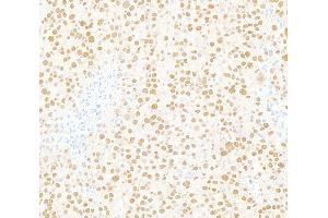 anti-5'-3' Exoribonuclease 2 (XRN2) (AA 900-950) antibody