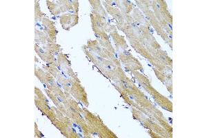 Immunohistochemistry (IHC) image for anti-Sorcin (SRI) (AA 1-198) antibody (ABIN6148444)