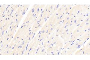 Detection of ABCD2 in Mouse Cardiac Muscle Tissue using Polyclonal Antibody to ATP Binding Cassette Transporter D2 (ABCD2) (CCL17 抗体  (AA 501-695))