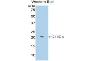 Western Blotting (WB) image for anti-Lysosomal-Associated Membrane Protein 2 (LAMP2) (AA 191-362) antibody (ABIN1174646) (LAMP2 抗体  (AA 191-362))