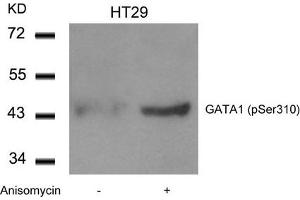 Western blot analysis of extracts from HT29 cells untreated or treated with Anisomycin using GATA1(Phospho-Ser310) Antibody. (GATA1 抗体  (pSer310))