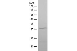 Western Blotting (WB) image for Methyl CpG Binding Protein 2 (MECP2) (AA 329-486) protein (His tag) (ABIN7123936)