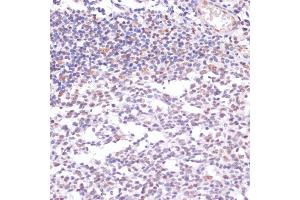 Immunohistochemistry of paraffin-embedded human tonsil using Acetyl-Histone H3-K23 antibody (ABIN7267669) at dilution of 1:100 (40x lens).