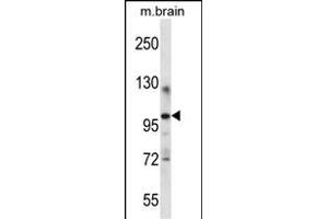 ITCH Antibody (Center) (ABIN657549 and ABIN2846563) western blot analysis in mouse brain tissue lysates (35 μg/lane). (ITCH 抗体  (AA 509-536))